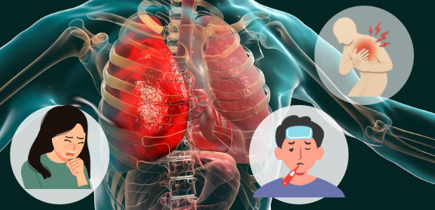 肺の炎症を示すイメージと、咳や発熱、胸の痛みを表すイラストを組み合わせた画像