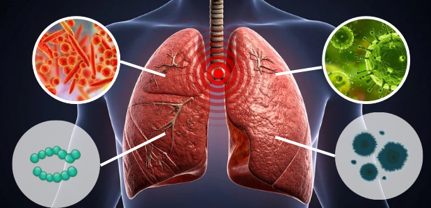 肺の内部構造と、細菌やウイルスなど感染要因を示すイメージ画像