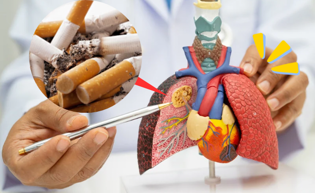 喫煙と、肺や心臓への影響を示す模型を組み合わせた画像