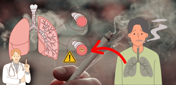喫煙と肺への影響を示す図とイラストを組み合わせた画像