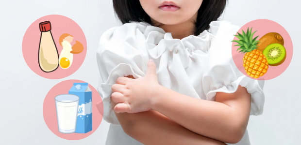 子どものかゆみの様子と、卵・乳製品・果物などアレルゲンを示すイラストを組み合わせた画像