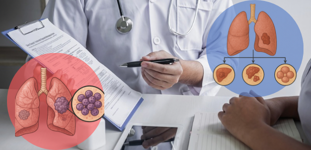 医師の診察シーンと、肺の状態変化を示すイメージ図を組み合わせた画像