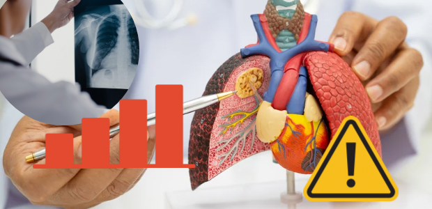 肺の模型に、検査結果や注意を示すグラフとアイコンを重ねた画像