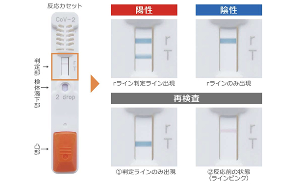 PCR