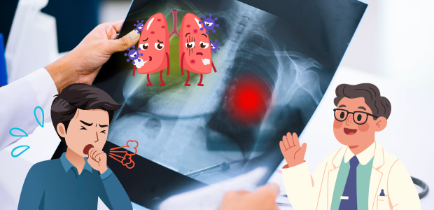 レントゲン検査で分かる病気について医師が患者へ説明している様子