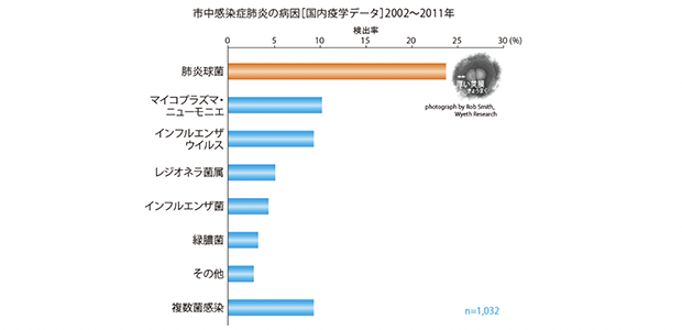 市中肺炎の病因