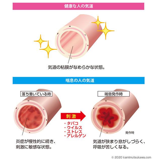 リモデリング