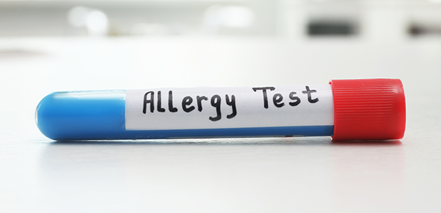 アレルギーテスト