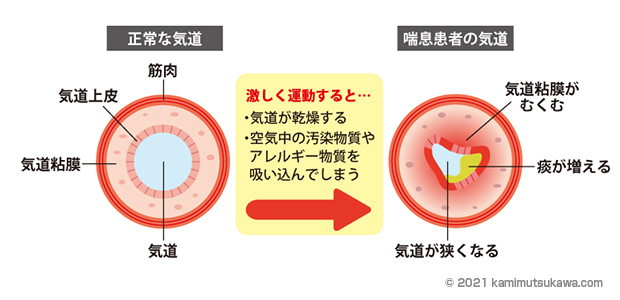 喘息運動イラスト