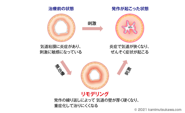 喘息と 天気や気候の関係を解説します 横浜弘明寺呼吸器内科クリニック健康情報局