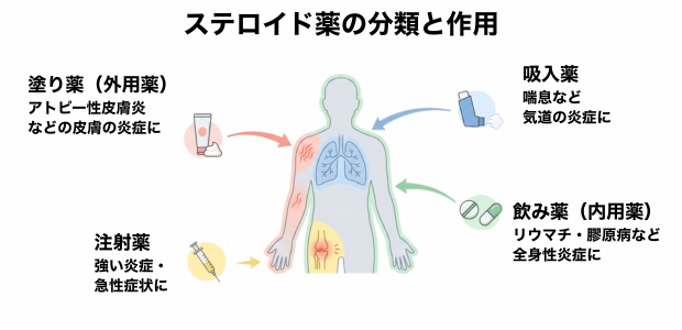 ステロイド薬の分類と作用を示した図解