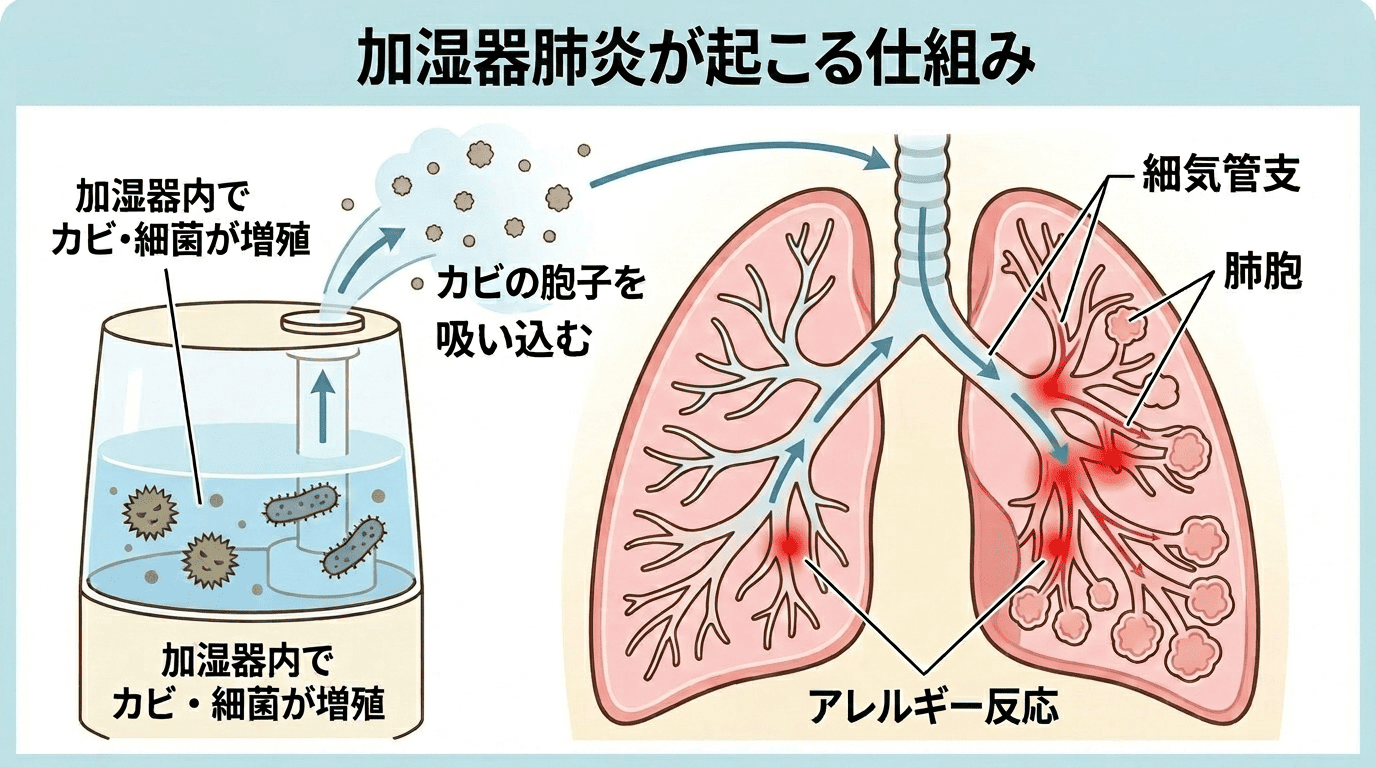 咳が止まらない原因は加湿器？ 「加湿器肺炎」の症状と対策について