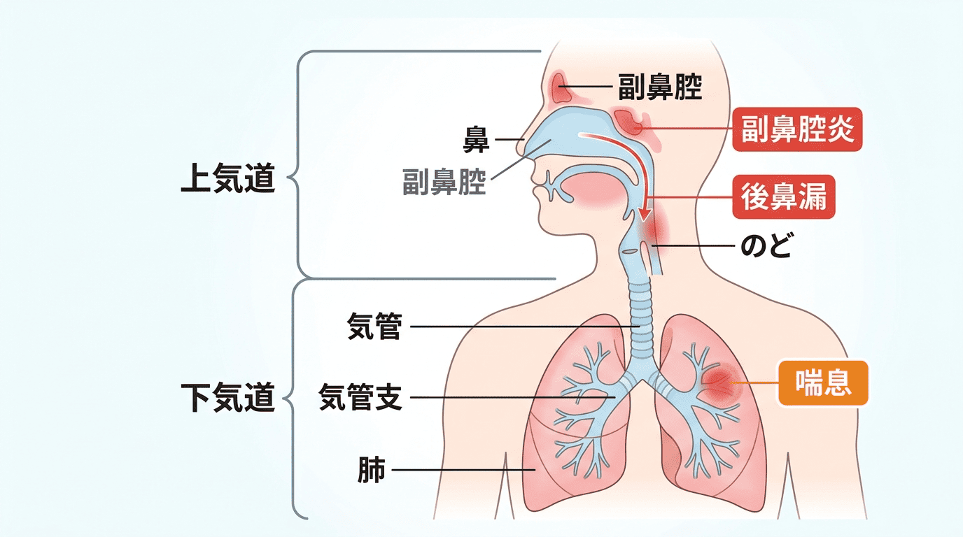 副 鼻腔 炎 喘息
