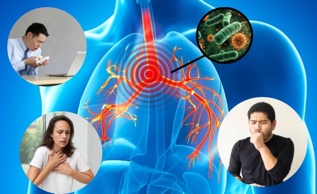 気管支の炎症部位と咳や息苦しさの様子から気管支拡張症の症状を示す図